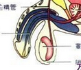 勃起功能障碍有
